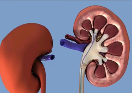چه عواملی ورزشکاران را در معرض بیماری‌های کلیوی و مجاری ادرار قرار می‌دهد؟